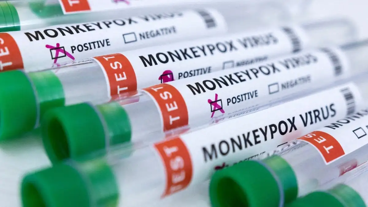κρούσμα mpox Ελλάδα 2026 Ιωάννινα